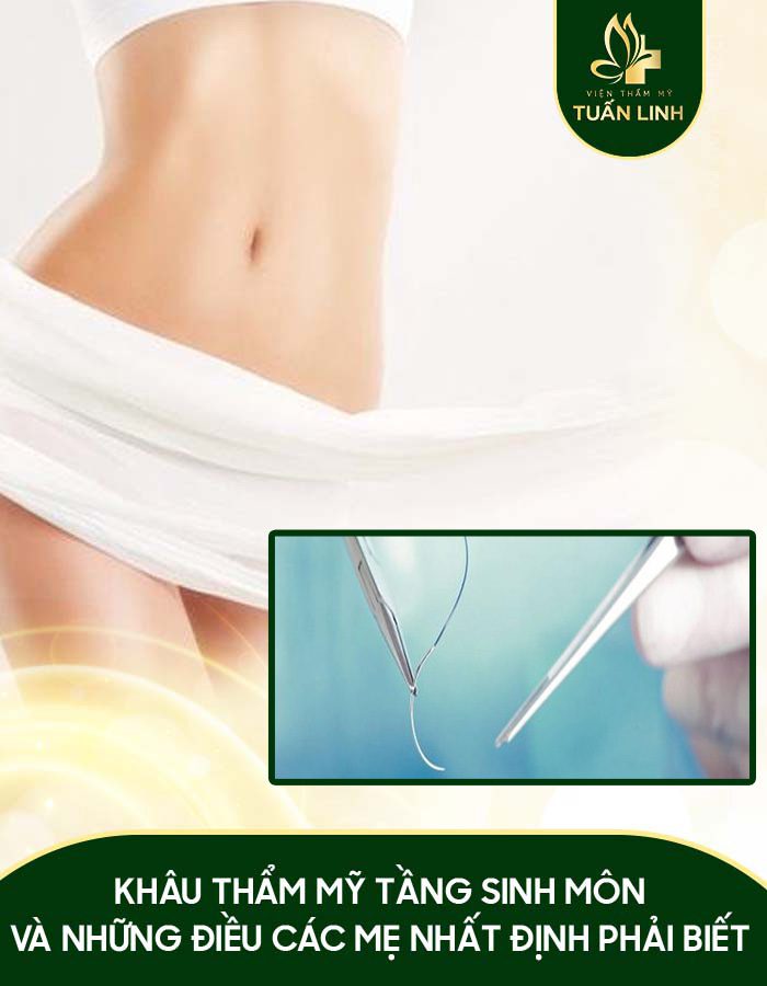 thẩm mỹ tầng sinh môn